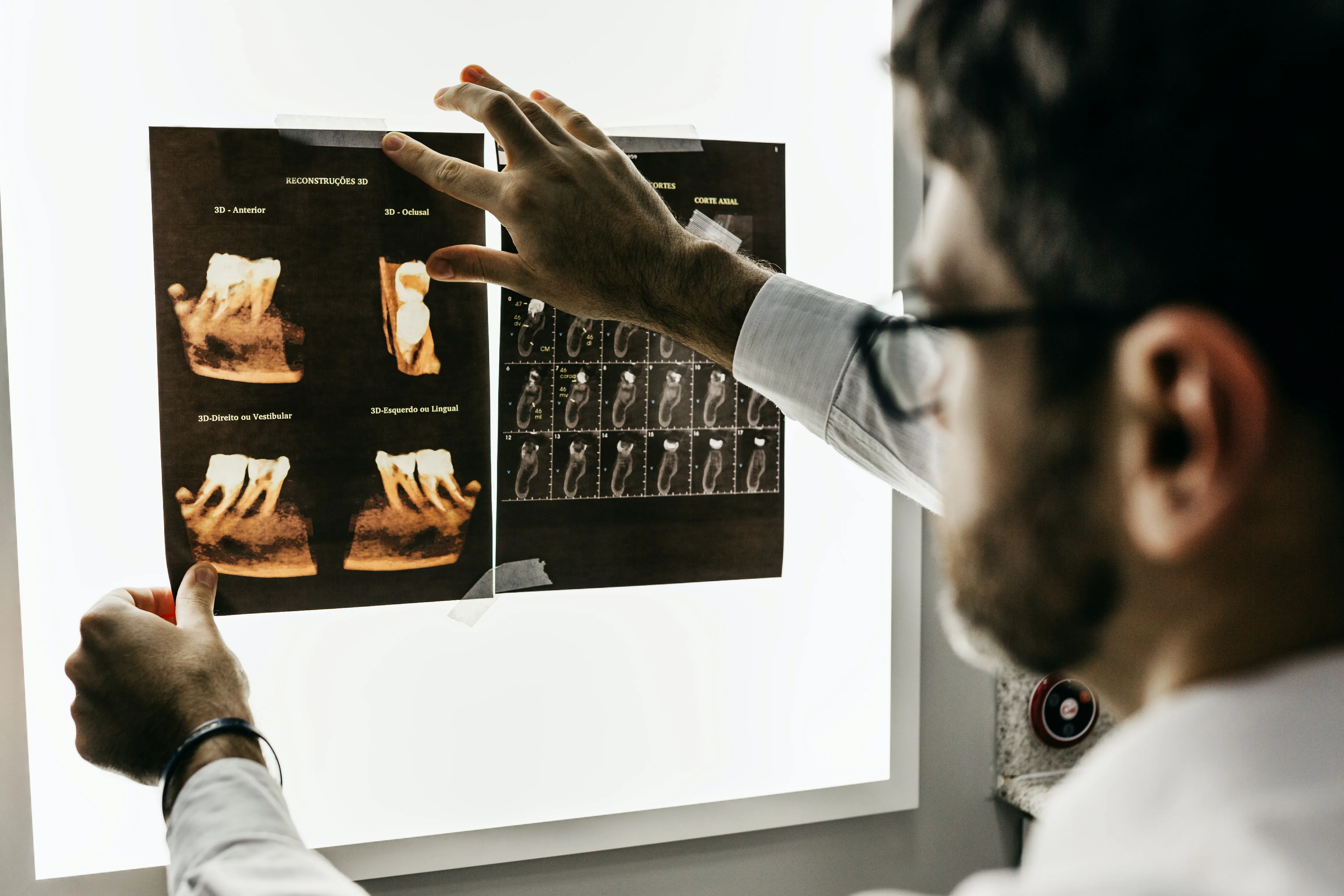Dentist examining 3D reconstructions of a tooth's roots